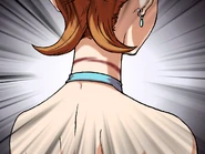 Показывает рану на шее