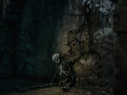 Кости и костяшки