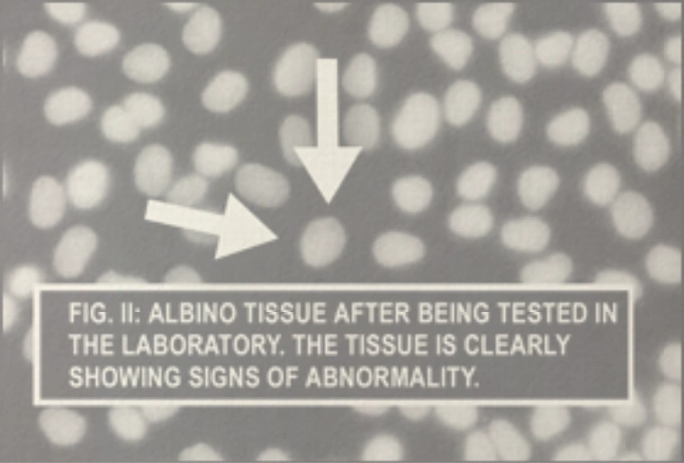 Альбинизм - это редкая генетическая болезнь