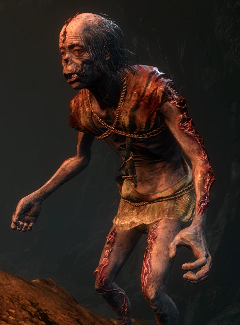 Разлагающийся заключённый